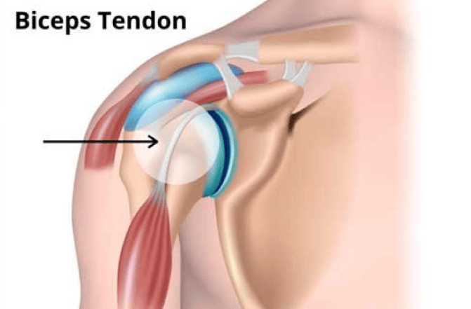 diagram showing biceps tendon